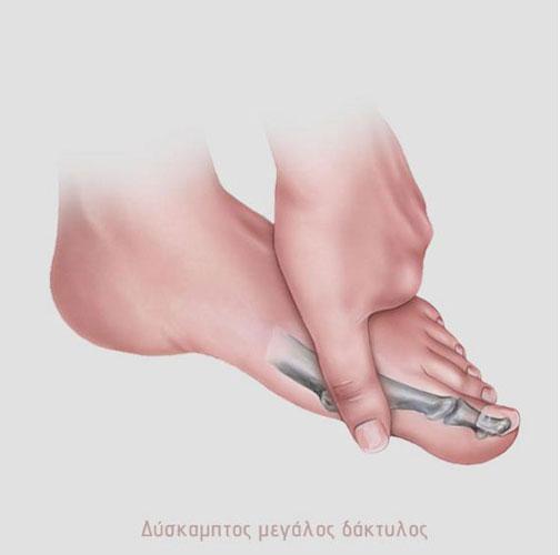 Μπαξεβάνος Νικόλαος - Χειρουργός ορθοπεδικός - Χολαργός