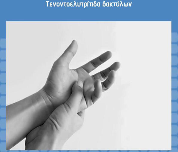 Μπαξεβάνος Νικόλαος - Χειρουργός ορθοπεδικός - Χολαργός