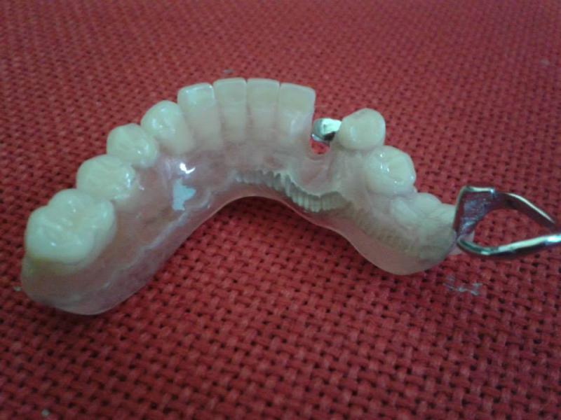 XG Dental - Οδοντοτεχνικό εργαστήριο - Θεσσαλονίκη