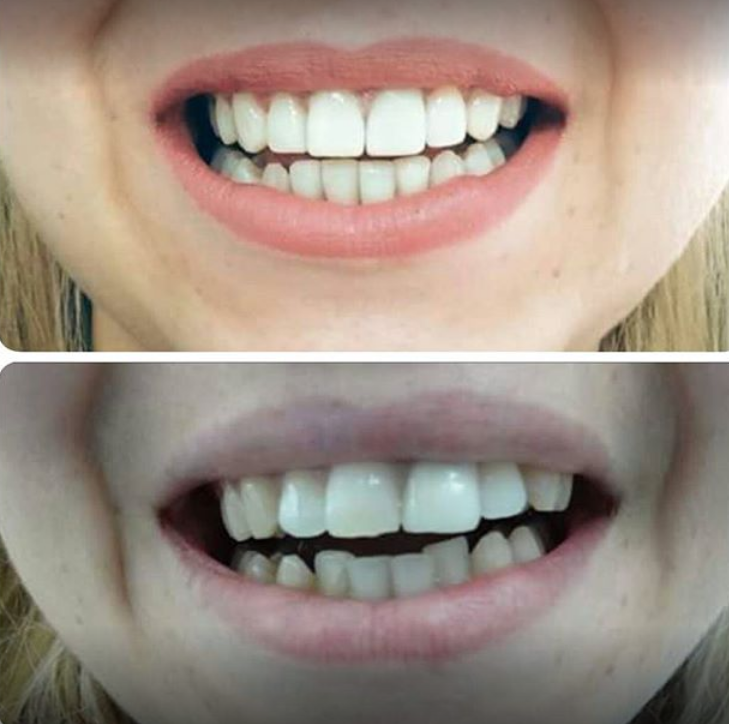 Smile design - Οδοντιατρικό κέντρο - ΘΕΣΣΑΛΟΝΙΚΗ - Καλαμαριά