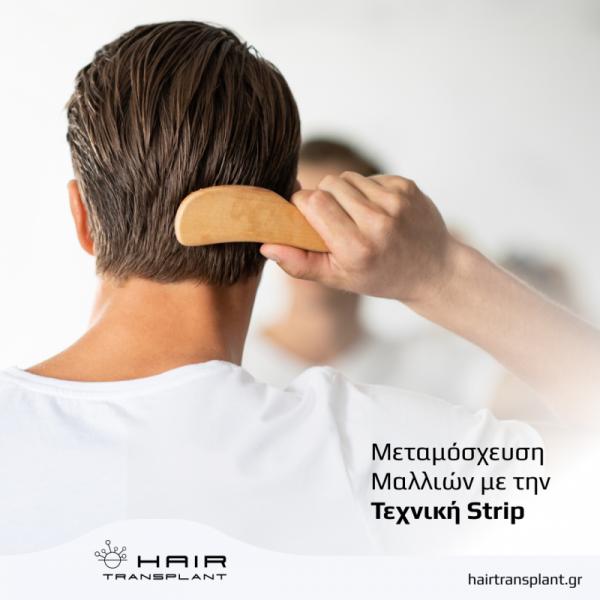 hairtransplant.gr Κέντρο μεταμόσχευσης μαλλιών
