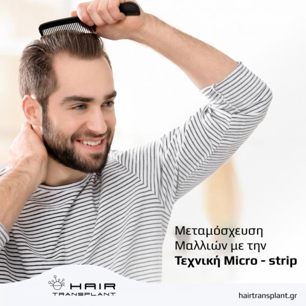 hairtransplant.gr Κέντρο μεταμόσχευσης μαλλιών