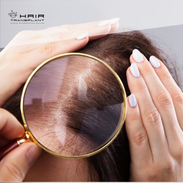 hairtransplant.gr Κέντρο μεταμόσχευσης μαλλιών