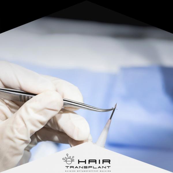 hairtransplant.gr Κέντρο μεταμόσχευσης μαλλιών