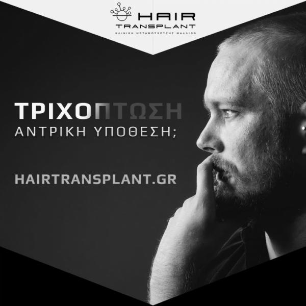 hairtransplant.gr Κέντρο μεταμόσχευσης μαλλιών